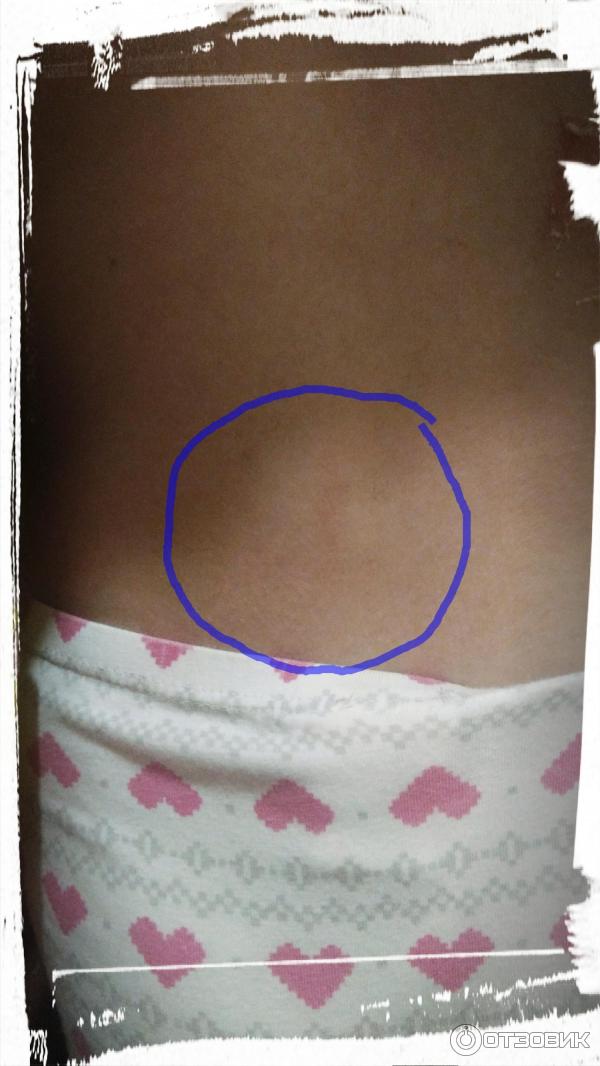 Гель Биолит Арктика фото