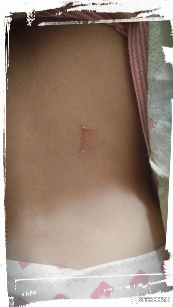 Гель Биолит Арктика фото