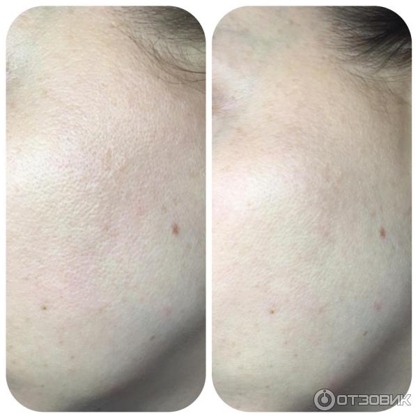 Пилинг гликолевый Medical Collagene 3D Easy peel фото