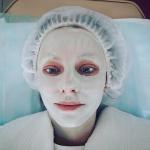 Радиоволновый лифтинг фото