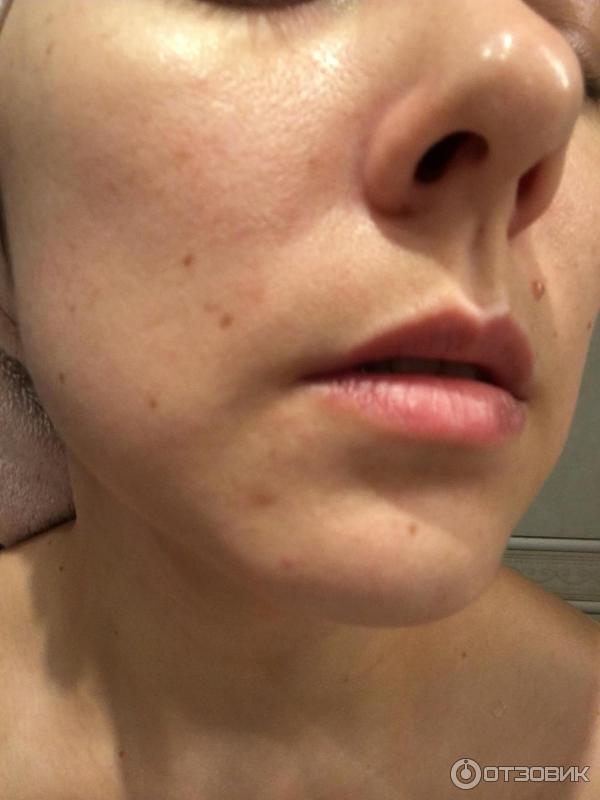 Пилинг для лица Alpha-H Гликолевый Liquid Gold фото