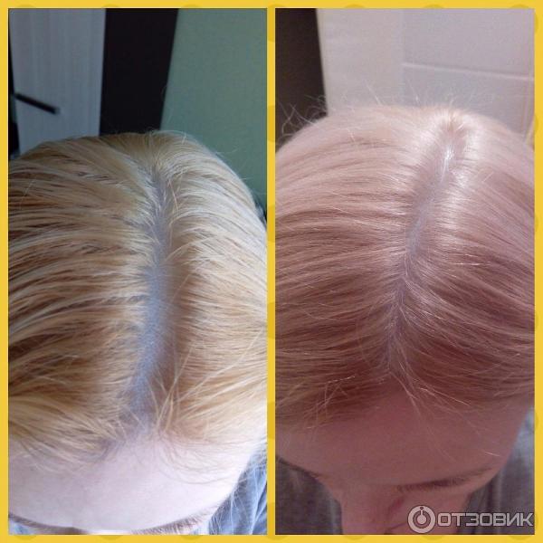 Краска для волос Schwarzkopf Color Expert OmegaPlex фото