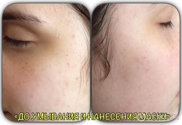 Очищающая маска для лица Skinlite Манго на основе грязи мертвого моря фото