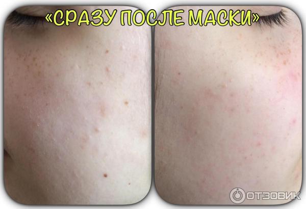 Очищающая маска для лица Skinlite Манго на основе грязи мертвого моря фото