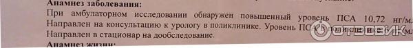 Биопсия предстательной железы под контролем УЗИ