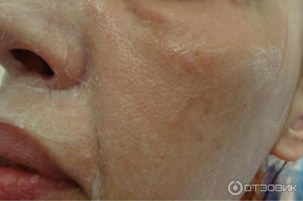 2-х шаговый антивозрастной уход против морщин Eveline Cosmeticcs Laser Precision фото